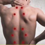 نقاط ماشه ای؛ عامل بسیاری از درد ها